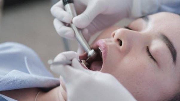 2026 Hong Kong Root Canal Tooth Discolouration Emergency Guide: Canossa Hospital Dentist Discusses Internal Bleaching Costs and Process