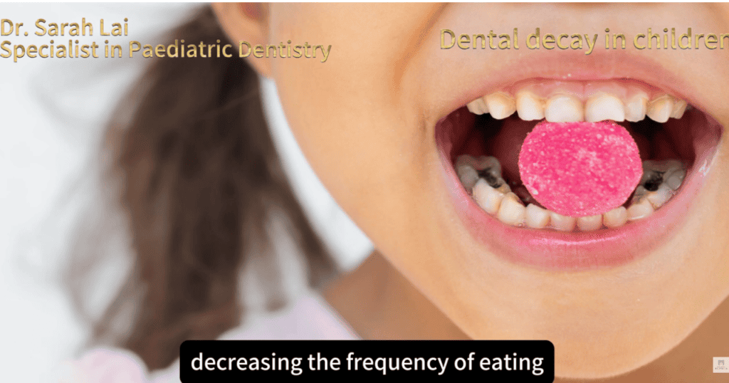 兒童蛀牙成因-糖果與蛀蝕-Causes-of-Child-Tooth-Decay-Candy-and-Caries-Prevention-Dr-Sarah-Lai