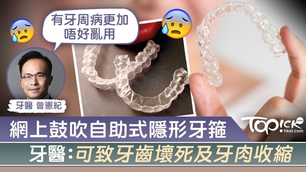 Dentist examining patient teeth to assess orthodontic treatment needs before clear aligner therapy